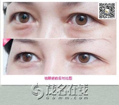 113354p25twuydwhb5wwhn.jpg